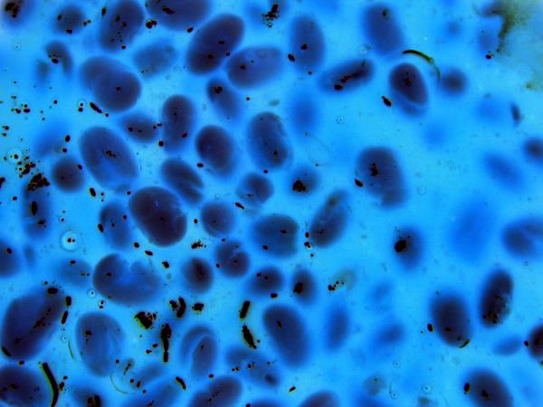 Rak ni nevaren, nevarne so metastaze